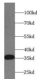REDD1 specific antibody