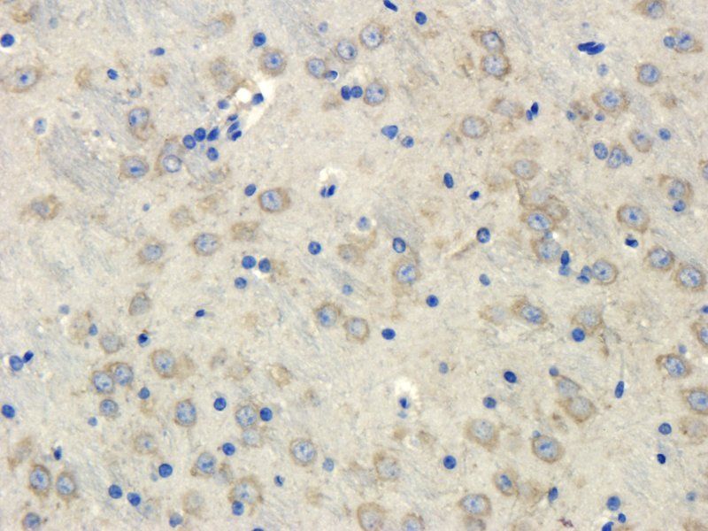 Reelin Rabbit Polyclonal Antibody
