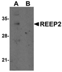 REEP2 Antibody