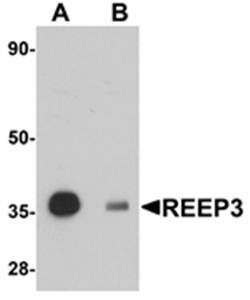 REEP3 Antibody