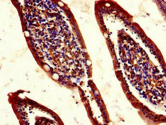 REG1A Antibody