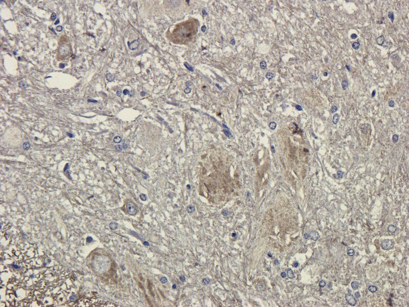 Reg3 gamma Rabbit Polyclonal Antibody