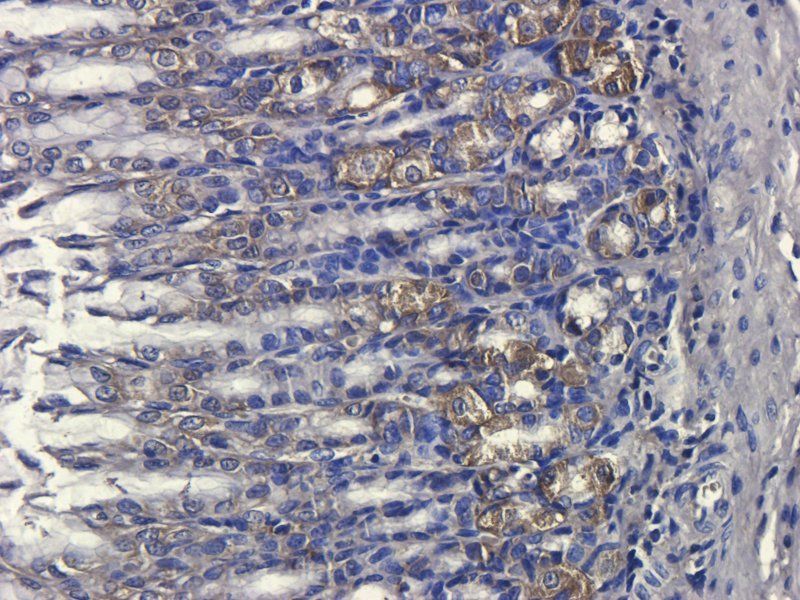 Reg3 gamma Rabbit Polyclonal Antibody