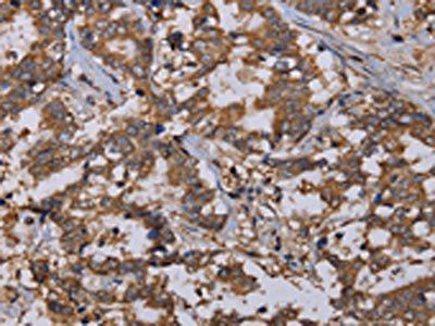 REG3G Antibody