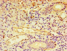 Regulator of G-protein signaling 20 antibody