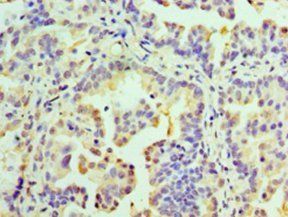 RMDN3 Antibody
