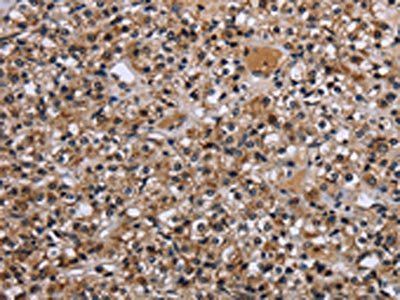 REL Antibody