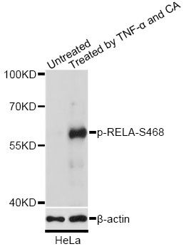 RELA (Phospho-S468) antibody