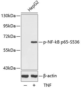 RELA (Phospho-S536) antibody