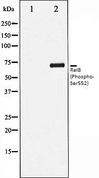 RelB (Phospho-Ser552) antibody