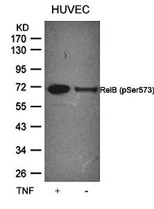 RelB (Phospho-Ser573) Antibody