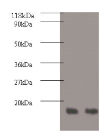 Replication protein A 14 kDa subunit antibody
