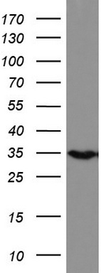 Repulsive Guidance Molecule A Antibody