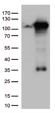 Repulsive Guidance Molecule A (RGMA) antibody