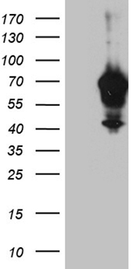 Repulsive Guidance Molecule C (HFE2) antibody