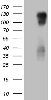 Repulsive Guidance Molecule C (HFE2) antibody