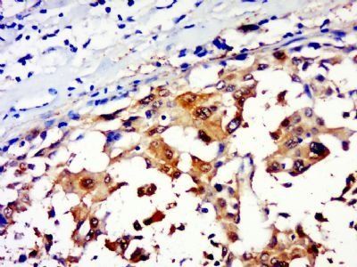Resistin Rabbit Polyclonal Antibody