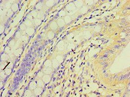 RET Antibody