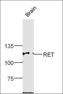 RET antibody
