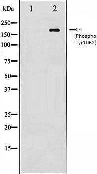 Ret (Phospho-Tyr1062) antibody