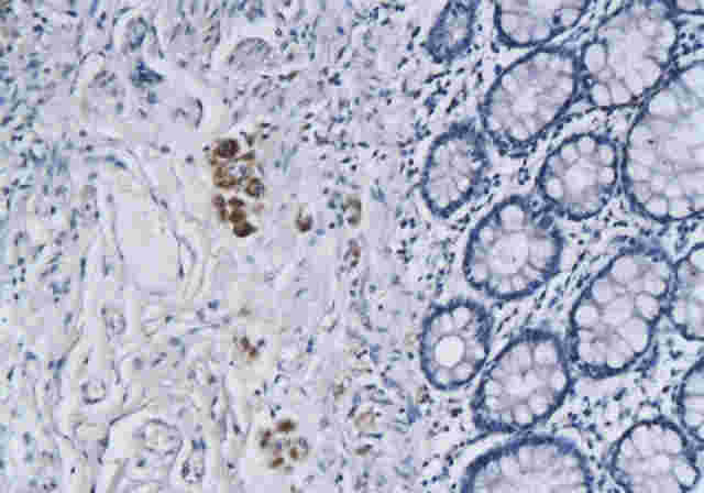 Phospho-Ret (Tyr1062) Rabbit Polyclonal Antibody