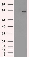 Retinal S antigen (SAG) antibody