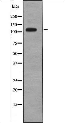 Retinoblastoma (Phospho-Thr373) antibody