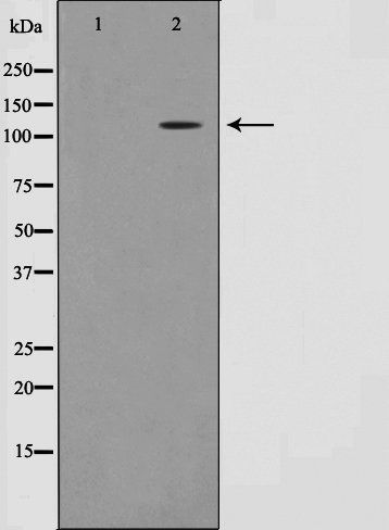 Retinoblastoma (Phospho-Thr826) antibody