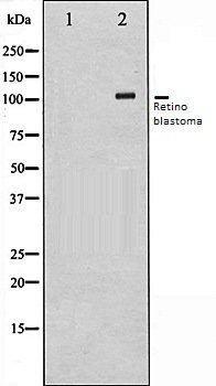Retinoblastoma antibody
