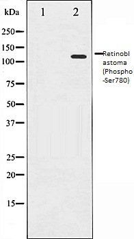 Retinoblastoma (Phospho-Ser780) antibody