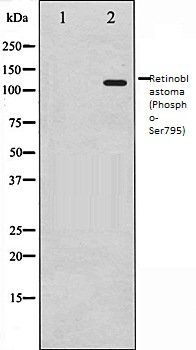 Retinoblastoma (Phospho-Ser795) antibody