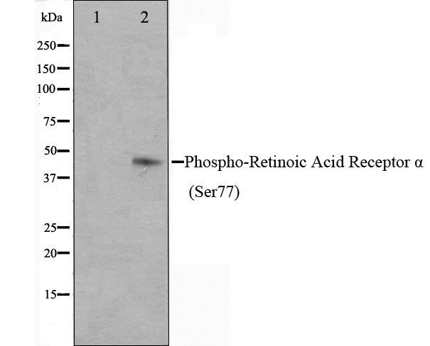 Retinoic Acid Receptor alpha (Phospho-Ser77) antibody