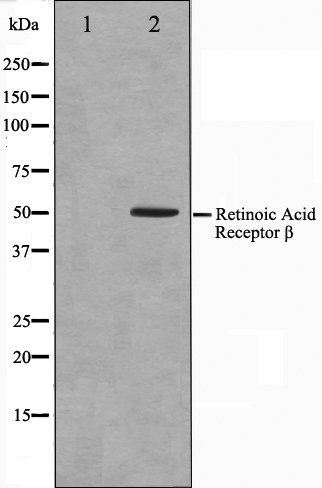 Retinoic Acid Receptor beta antibody