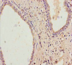 Retinol dehydrogenase 11 antibody