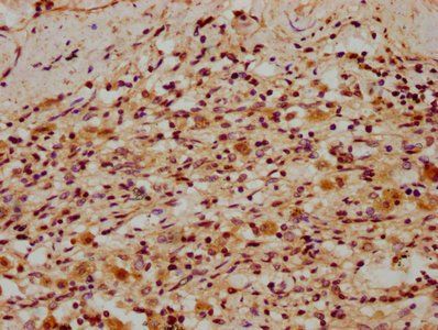 REV1 Antibody