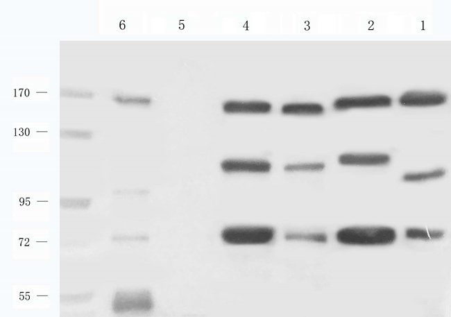 REV1 antibody