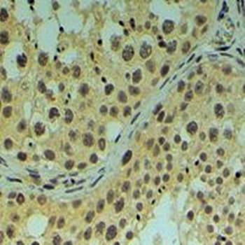 Goat anti-REV1L Antibody