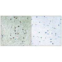 REXO1 Antibody