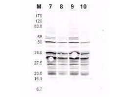 RFA2 (phospho-S122) antibody