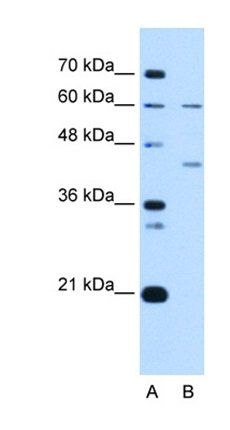 RFC5 antibody