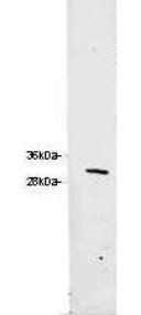 RFP antibody (Biotin)