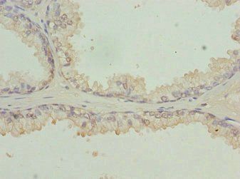RFPL2 Antibody