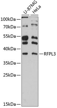 RFPL3 antibody