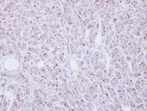RGMB antibody [N3C3]
