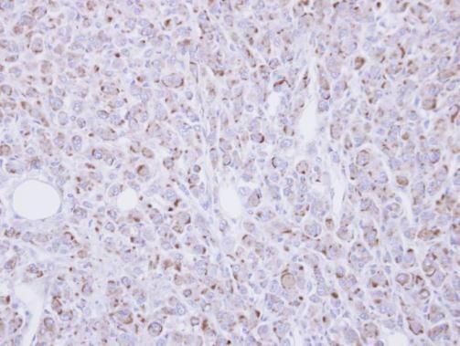 RGMB antibody