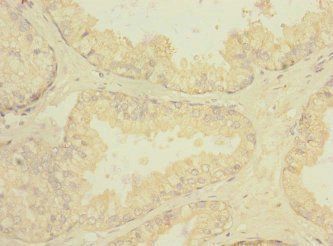 RGR Antibody