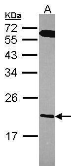 RGS10 Rabbit Polyclonal Antibody