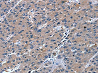 RGS11 antibody