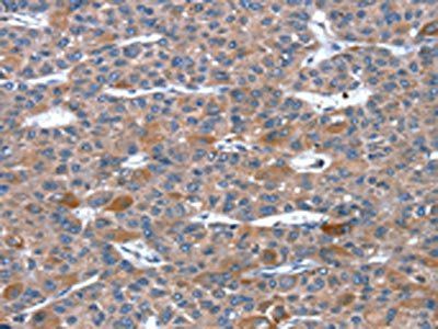RGS11 Antibody