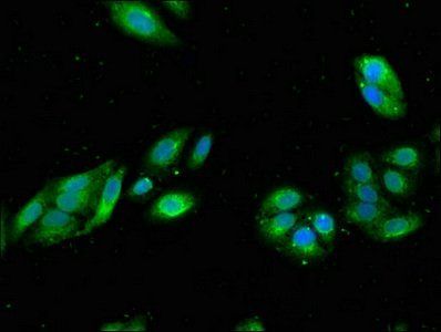 RGS19 Antibody